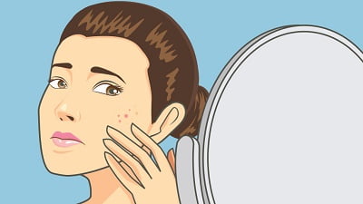 Top 9 most effective home remedies for acne on face