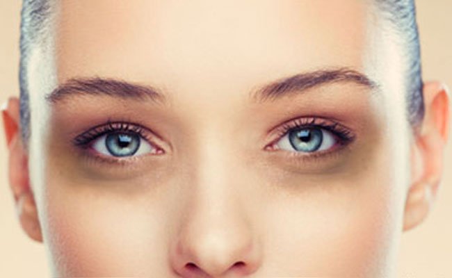 how to remove dark circles under eyes permanently